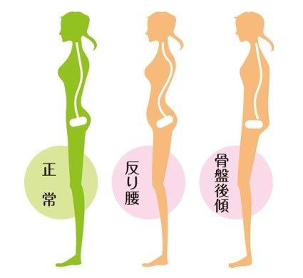 骨盤の傾き