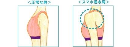 猫背と巻き肩